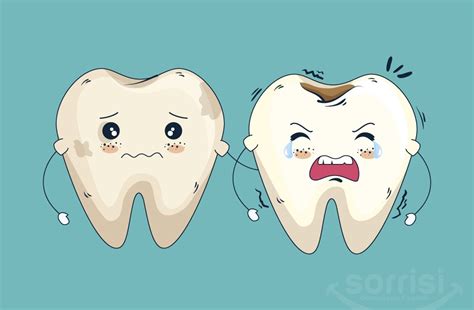 Como Prevenir E Tratar Cárie Dental Clínica Sorrisi