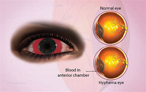 Health Condition : Symptoms, Causes, Treatment and More