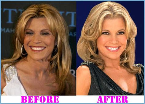 Vanna White Plastic Surgery Before And After Photos
