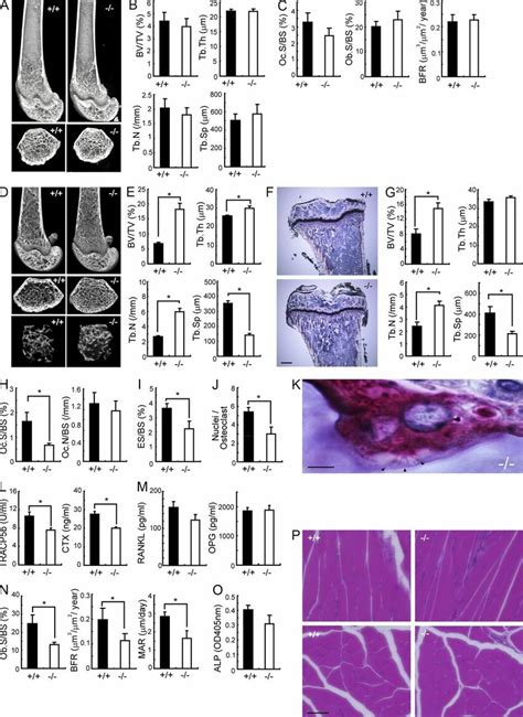 Osteopetrotic Phenotype Of 10 Wk Old Sbno2 Mice A Representative