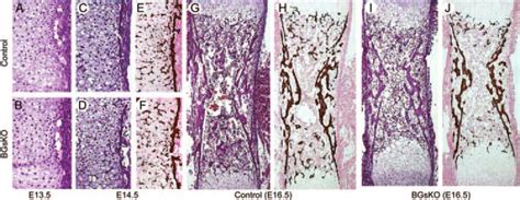 histology  bone nursing lecture