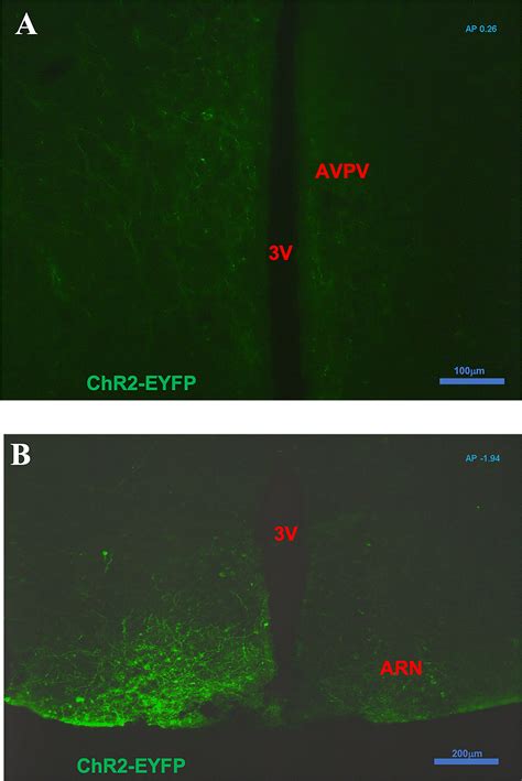 Frontiers Optogenetic Activation Of Arcuate Kisspeptin Neurons