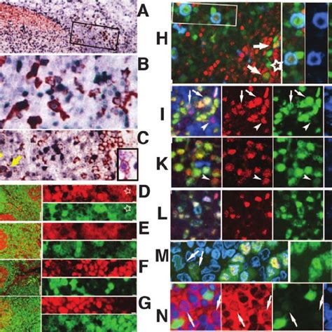 Bcl6 Expression In Human Tonsil B Cells Subsets Five Human B Cells Download Scientific Diagram