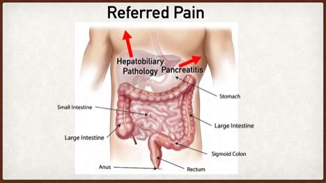 Liver Pain? Right Upper Abdominal Right Upper Quadrant Pain, 57% OFF