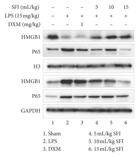 Sfi Inhibits The Translocation Of Hmgb1 And P65 Between The Nuclei And