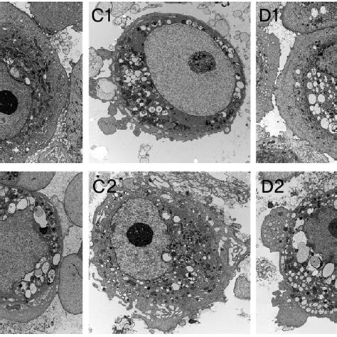 Transmission Electron Micrographs Of Corneal Epithelial Cells