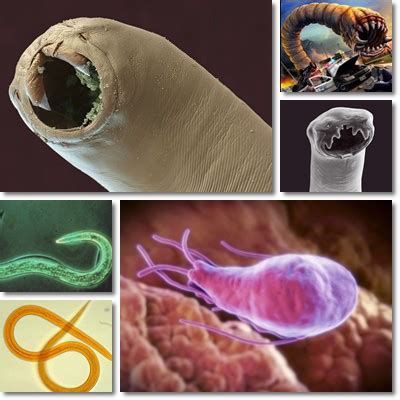 Worms and Intestinal Parasites: Causes, Symptoms and Treatment – NatureWord