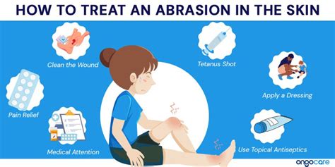 Abrasion: Types, Symptoms, Treatment - Ongo Care