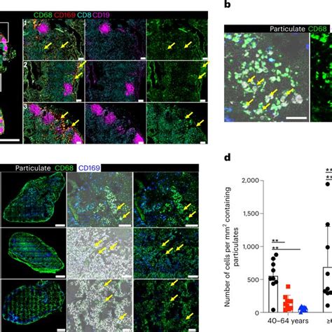 The CD68CD169 Subset Of LN Macrophages Localize Within The T Cell