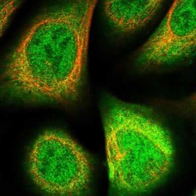 Biliverdin Reductase B/BLVRB Antibody (NBP1-83435): Novus Biologicals