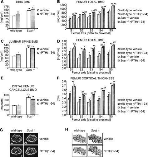 PTH induced bone gain is blunted in Sost À À mice Overall BMD in the