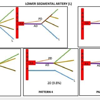 Lower segmental artery (L) showing five variant patterns of its origin ...