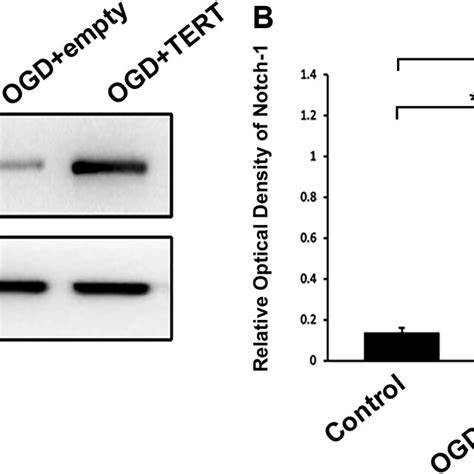 Telomerase Reverse Transcriptase Enhances The Expression Of Notch 1 In