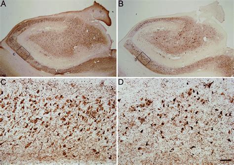 Photomicrographs Showing The Pattern Of Hyperphosphorylated Tau