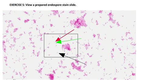 Solved Exercise View A Prepared Endospore Stain Slide Chegg