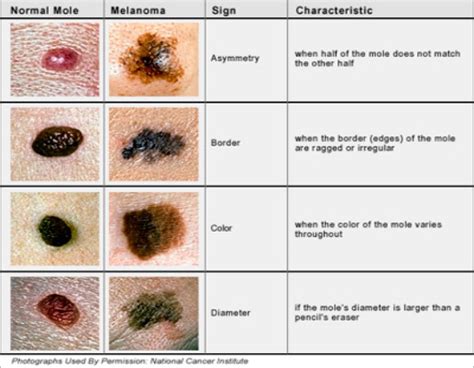 Describing Rashes Pictures Photos