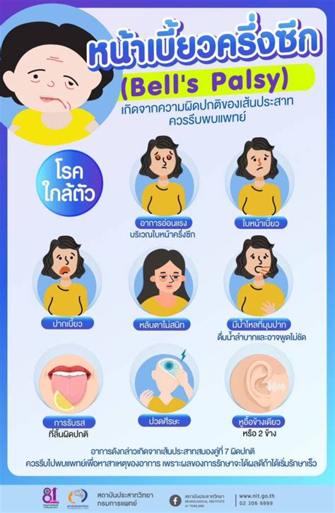 หน้าเบี้ยวครึ่งซีก Bell S Palsy ความผิดปกติของเส้นประสาท ควรรีบพบแพทย์