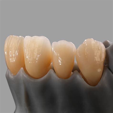 Material Dental De Dióxido De Circonio Zolid Gen X Amann Girrbach