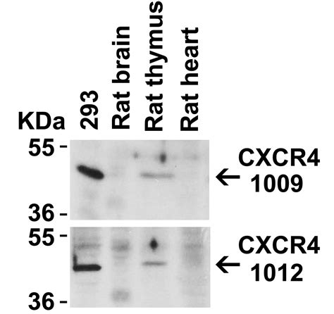 Anti Cxcr Nt Antibody Qed Bioscience Inc