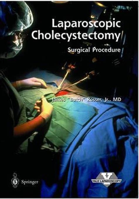 Laparoscopic Cholecystectomy Surgical Procedure James