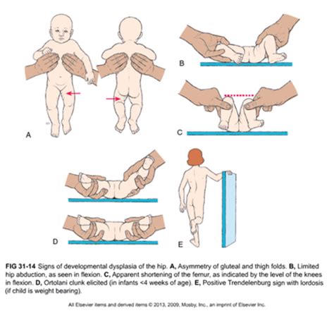 Pedi Exam 3 Flashcards Quizlet