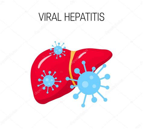 Concepto De Hepatitis Viral Ilustraci N Vectorial De Un H Gado Malsano