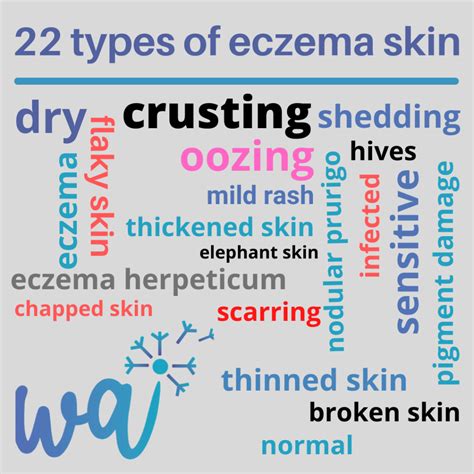 7 Types Of Eczema