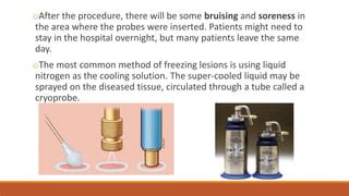 Cryosurgery | PPT