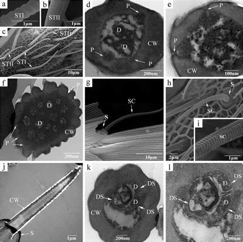 Scanning And Transmission Electron Micrographs Of Sensilla Trichodea