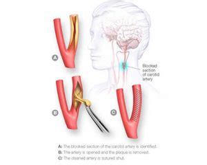 Dr Sunil V Furtado | Neurosurgeon