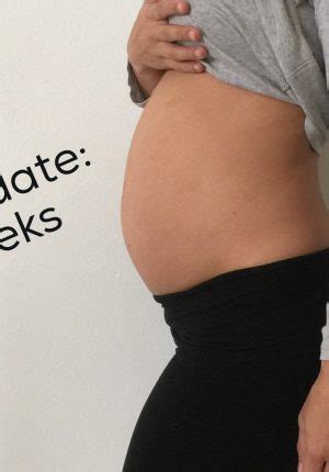 Kinesio Taping During Pregnancy Techniques For The Pregnant Belly