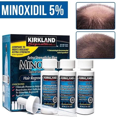 Kirkland minoxidil 5% | Lazada Indonesia