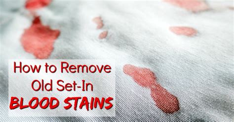 How To Get Rid Of Blood Stains Out Of Sheets At Sarah Toro Blog