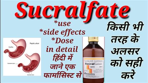 Sucralfate Suspension Uses Side Effects Dose And Precautions In Hindi Youtube