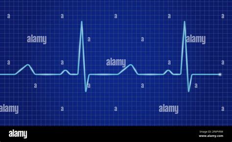 Cardiogram Cardiograph Oscilloscope Blue Screen Heartbeat Line