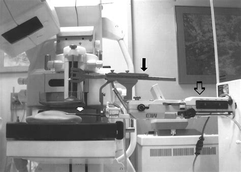 Stereotactic Biopsy Of The Breast Using An Upright Unit A Vacuum Suction Needle And A Lateral