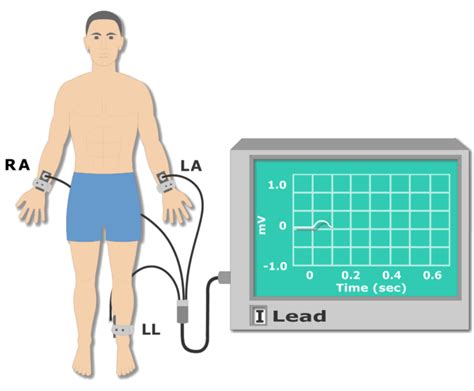 Ecg Electrode Placement Getbodysmart