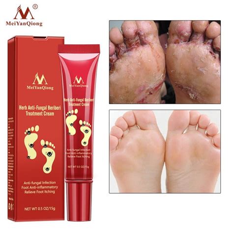 Anti Fungal Infection Herbal Foot Cream