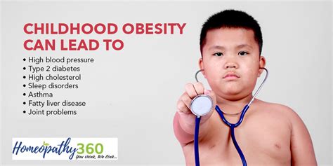 Childhood Obesity - Symptoms and Causes and Treatment with Homeopathy