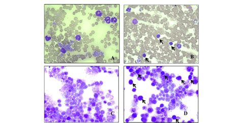 Leishman S Staining Of Peripheral Blood And Bone Marrow Smear Of Mice A