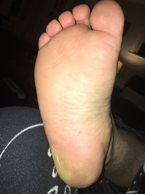 Gay Chubby Fat Feet On Tumblr