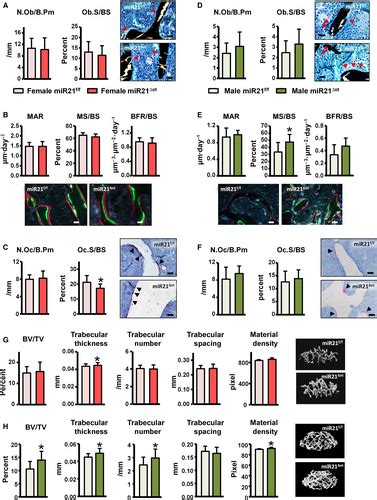 Osteocytic Mir21 Deficiency Improves Bone Strength Independent Of Sex Despite Having Sex