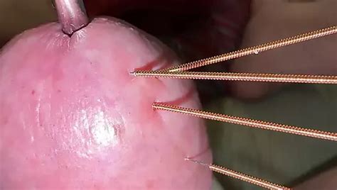 Asshole Torture Extreme Gay Man Porn XHamster