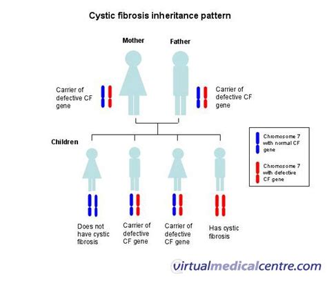 Cystic Fibrosis Causes Symptoms And Treatment Information Myvmc