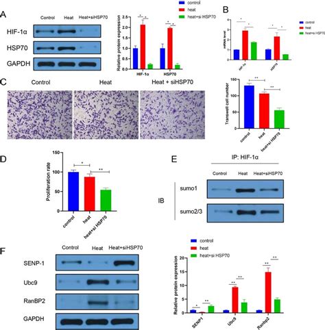 Effect Of Hsp Knockdown On Heat Treated A Lung Cancer Cell Lines