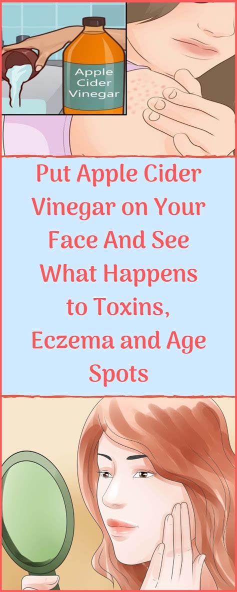 Put Apple Cider Vinegar On Your Face And See What Happens To Toxins Eczema And Age Apple