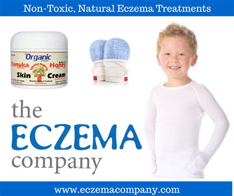 The Eczema Company review: best natural creams for eczema