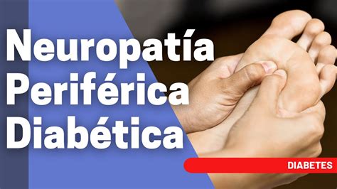 ¿qué Es La Neuropatía Periférica Diabética Youtube