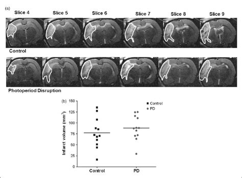 T 2 Weighted MRI Images Taken At 48 H Post MCAO Showing Hyper Intense