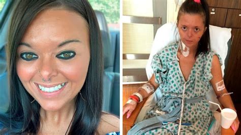 Ladbible News On Twitter 🔔 Woman Addicted To Vaping Left On Life Support With Deadly Lung